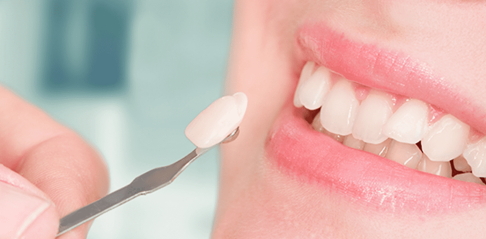 Tips For Keeping Your Teeth White