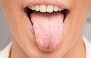 Foods That Kill Bacteria In The Mouth