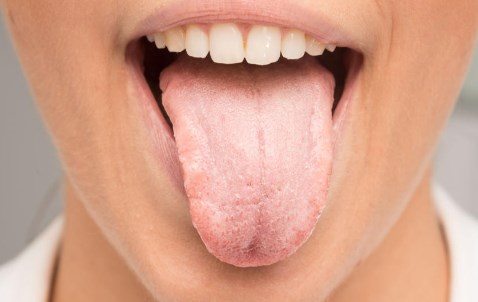 Why Is Dry Mouth Risky For Your Teeth?
