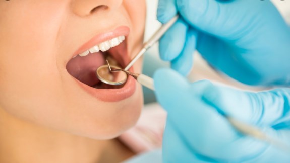 10 Reasons to visit your Kyle Dentist