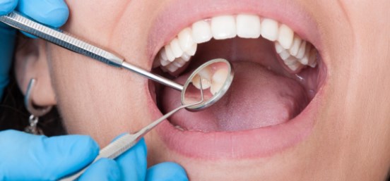 How To Get Rid Of A Tooth Infection Without Antibiotics