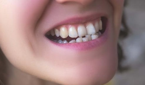 I Have Really Bad Teeth – What Are My Options?