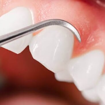 Professional Tips For Maintaining Healthy Gums and Fresh Breath