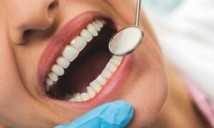 5 Tips to Keep Your Gums Healthy and Happy