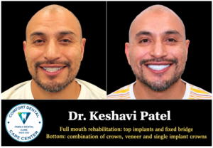 dental make over